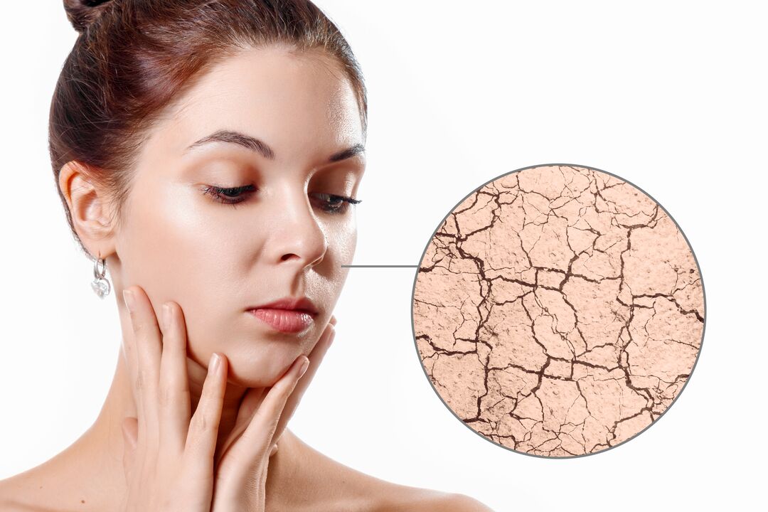 Befeuchtung trockener Haut mit Eudalie-Creme